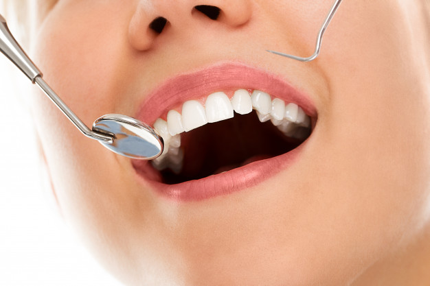 Diş Minesi Aşınmasının Belirtileri Nelerdir