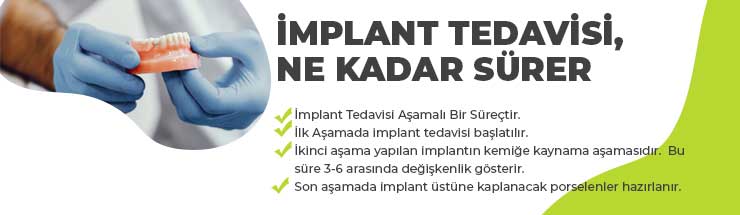implant-tedavisi-suresi